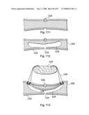 Devices for minimally invasive pelvic surgery diagram and image