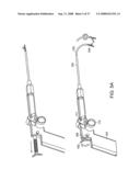 Method and Devices for Minimally Invasive Arthroscopic Procedures diagram and image