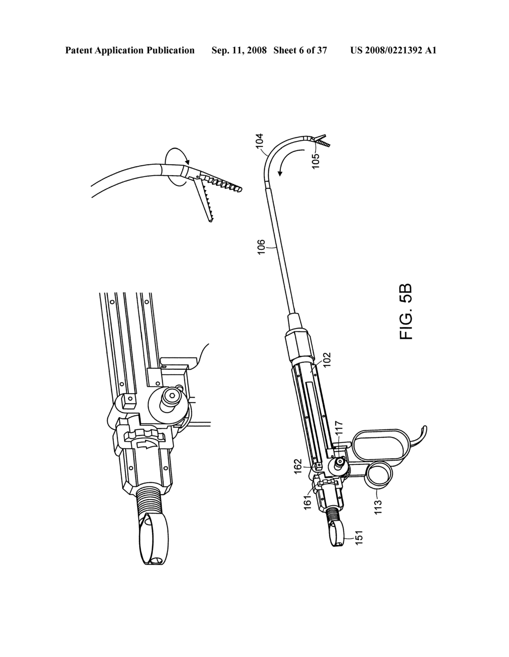 Method and Devices for Minimally Invasive Arthroscopic Procedures - diagram, schematic, and image 07