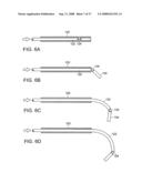 Method and Devices for Minimally Invasive Arthroscopic Procedures diagram and image