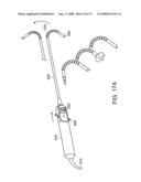 Method and Devices for Minimally Invasive Arthroscopic Procedures diagram and image