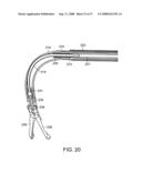 Method and Devices for Minimally Invasive Arthroscopic Procedures diagram and image