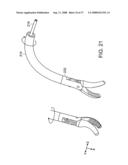 Method and Devices for Minimally Invasive Arthroscopic Procedures diagram and image