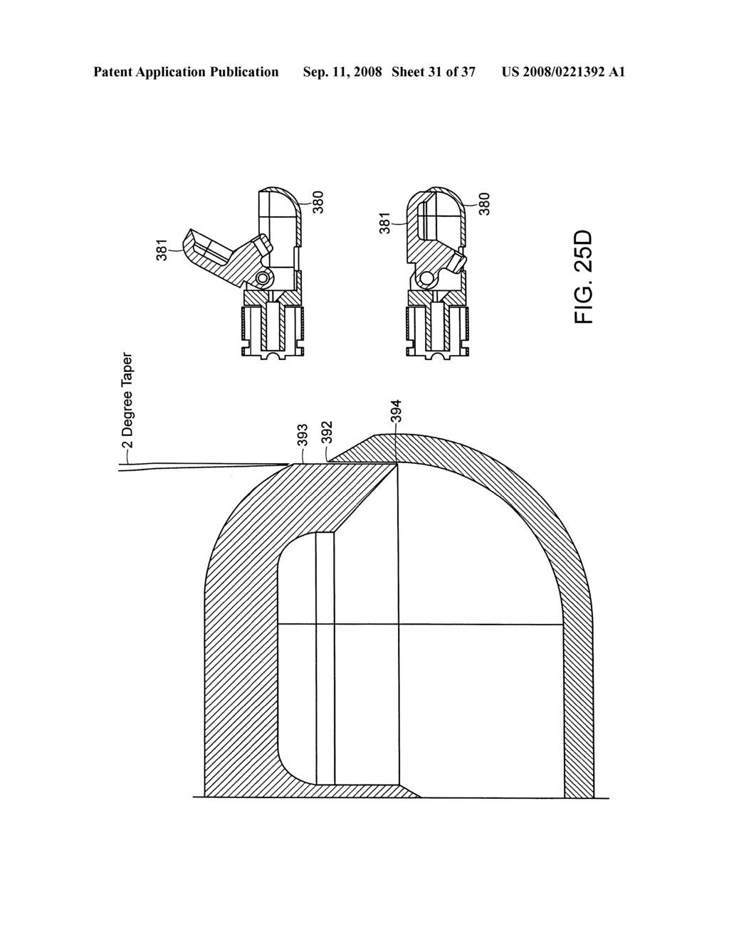 Method and Devices for Minimally Invasive Arthroscopic Procedures - diagram, schematic, and image 32