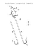 Method and Devices for Minimally Invasive Arthroscopic Procedures diagram and image