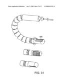 Method and Devices for Minimally Invasive Arthroscopic Procedures diagram and image