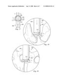 TISSUE RETRACTOR diagram and image