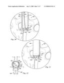 TISSUE RETRACTOR diagram and image