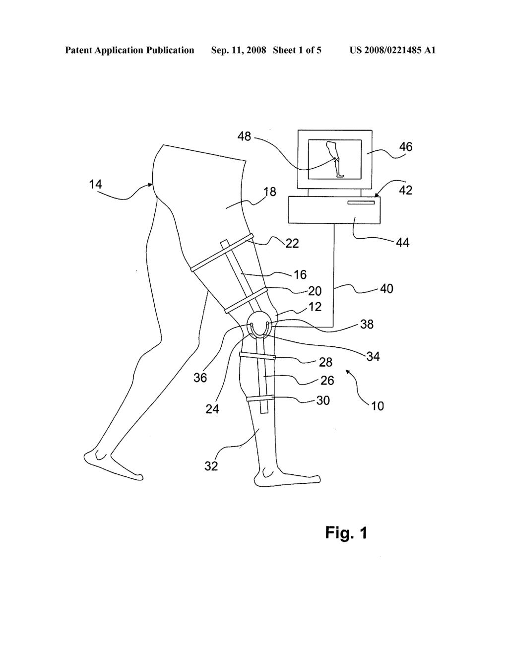 Device and Method for Determining at Least One Characteristic Point of Joint to be Orthopedically Measured - diagram, schematic, and image 02