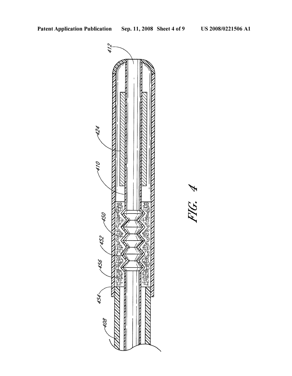 SMALL VESSEL ULTRASOUND CATHTER - diagram, schematic, and image 05