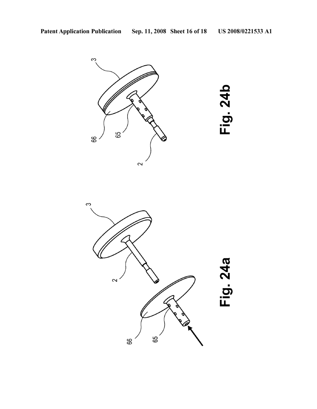 IMPLANTABLE DEVICE WITH BIOABSORBABLE LAYER, KIT AND METHOD FOR USE THEREWITH, AND APPARATUS FOR PREPARING SAME - diagram, schematic, and image 17