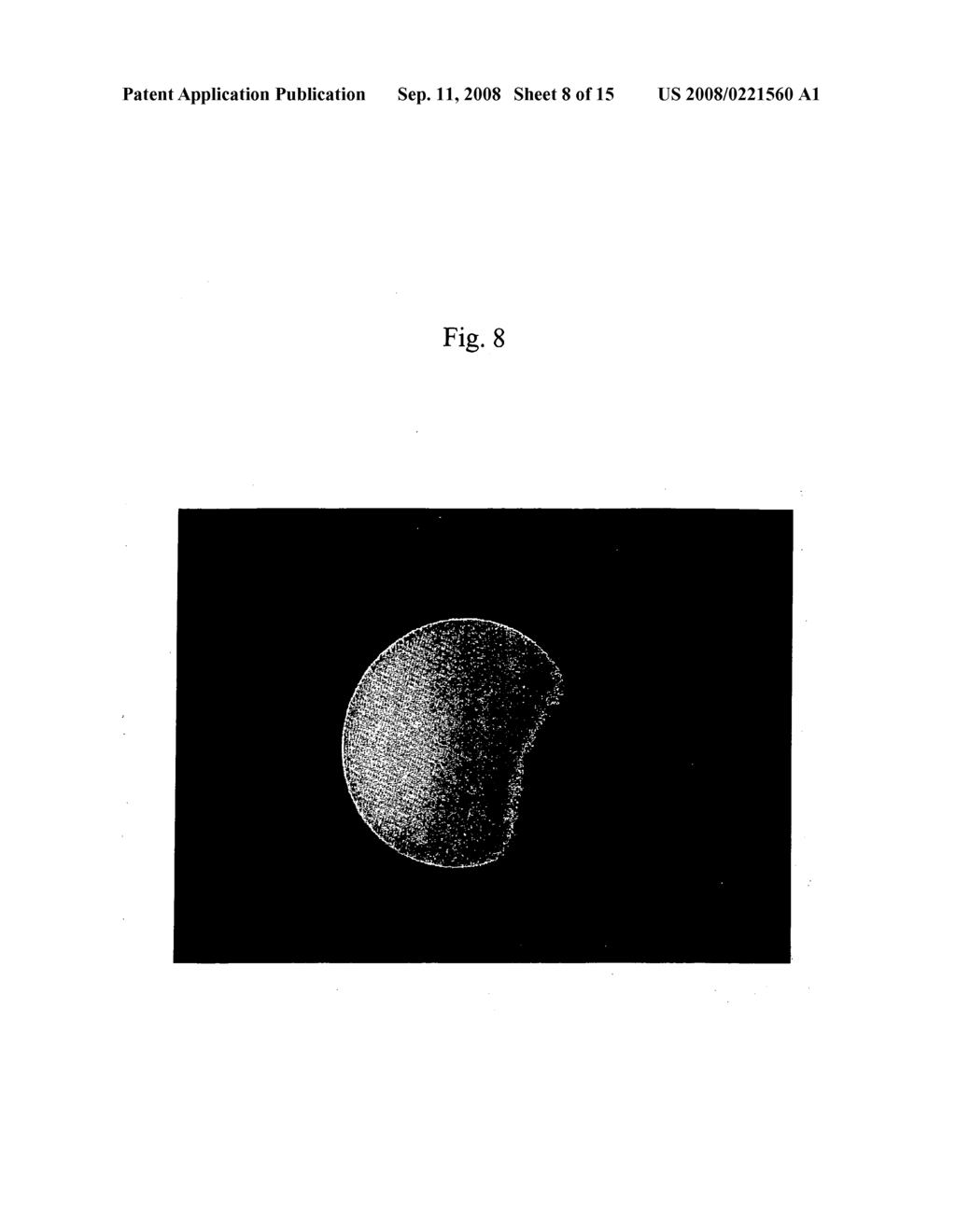 Intravascular Diagnostic or Therapeutic Apparatus Using High-Intensity Pulsed Light - diagram, schematic, and image 09