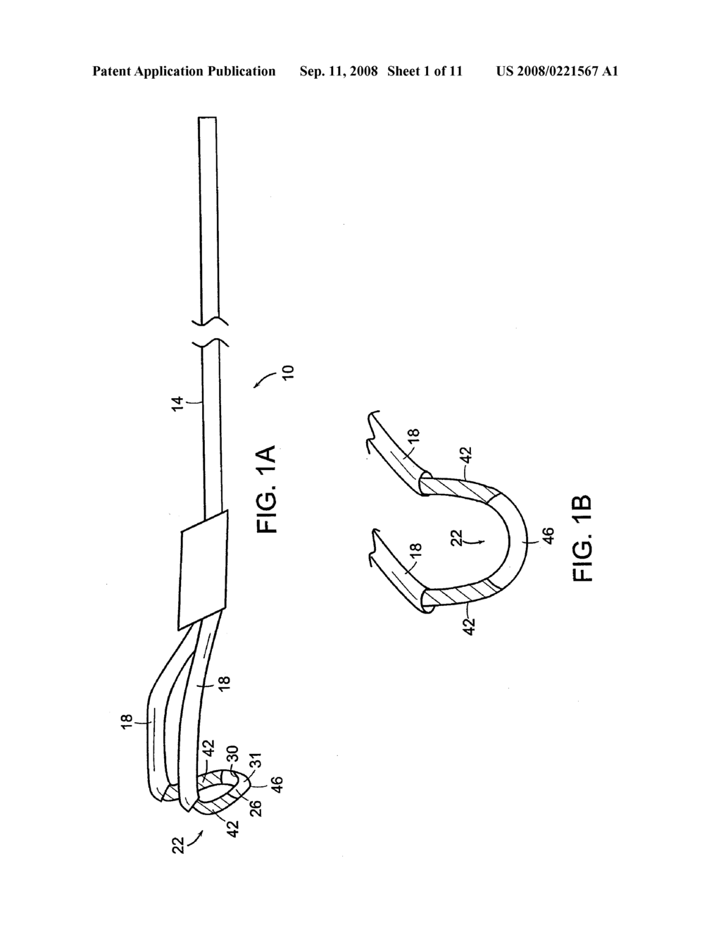 ELECTROSURGICAL TISSUE REMOVAL WITH A SELECTIVELY INSULATED ELECTRODE - diagram, schematic, and image 02