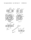 Orthopaedic instrumentation with integral load-bearing members diagram and image