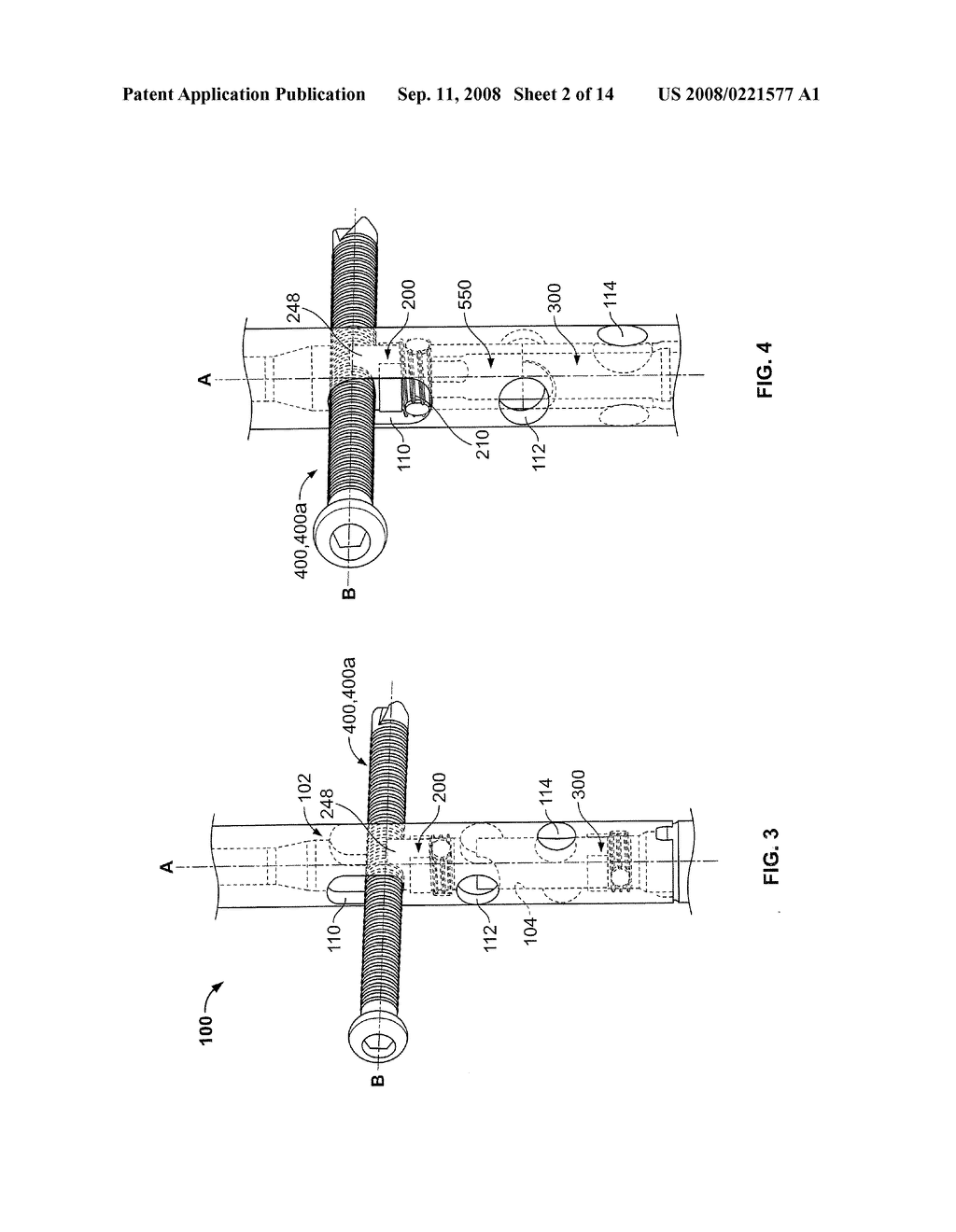 INTRAMEDULLARY IMPLANT WITH LOCKING AND COMPRESSION DEVICES - diagram, schematic, and image 03