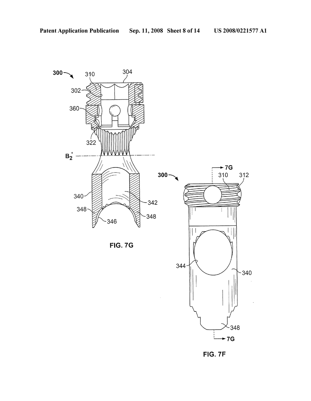 INTRAMEDULLARY IMPLANT WITH LOCKING AND COMPRESSION DEVICES - diagram, schematic, and image 09