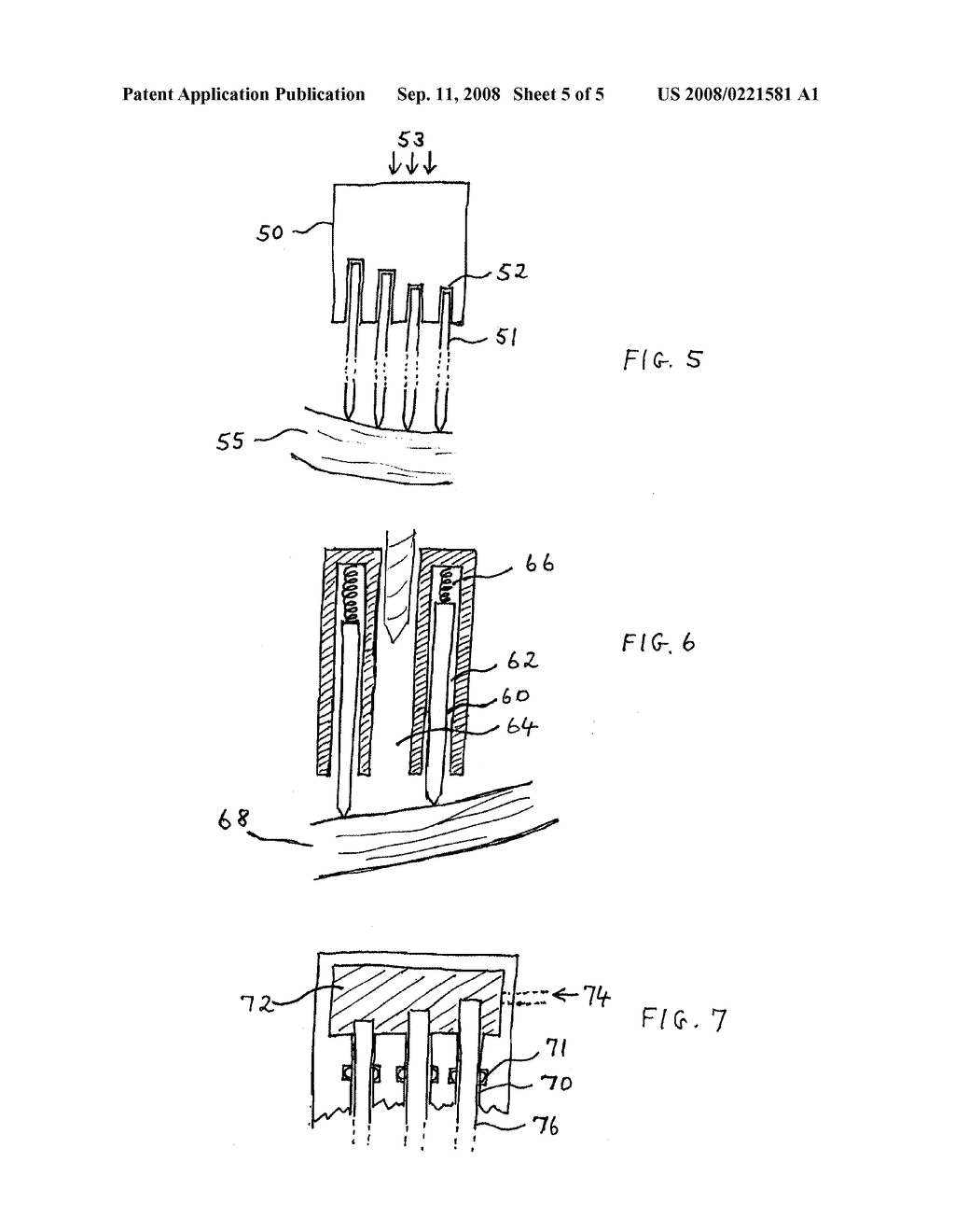 BONE DRILLING CANNULA - diagram, schematic, and image 06