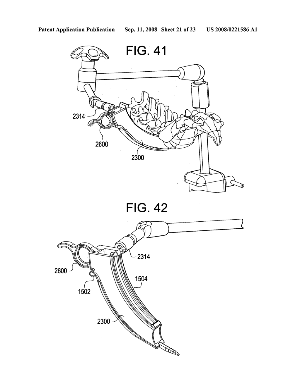 Curviliner spinal access method and device - diagram, schematic, and image 22