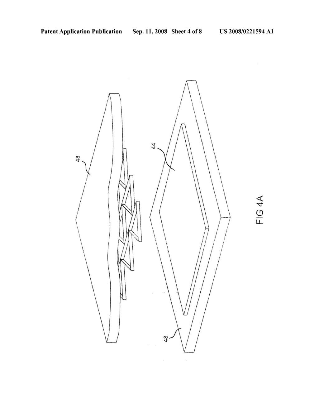 Resorbable truss - diagram, schematic, and image 05