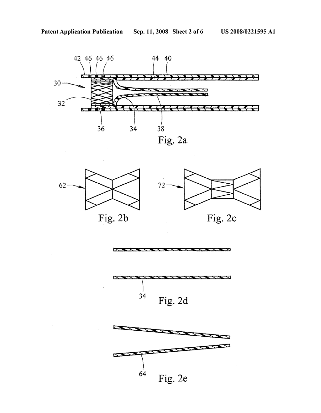 APPARATUS AND METHODS FOR DELAYING GASTRIC EMPTYING TO TREAT OBESITY - diagram, schematic, and image 03