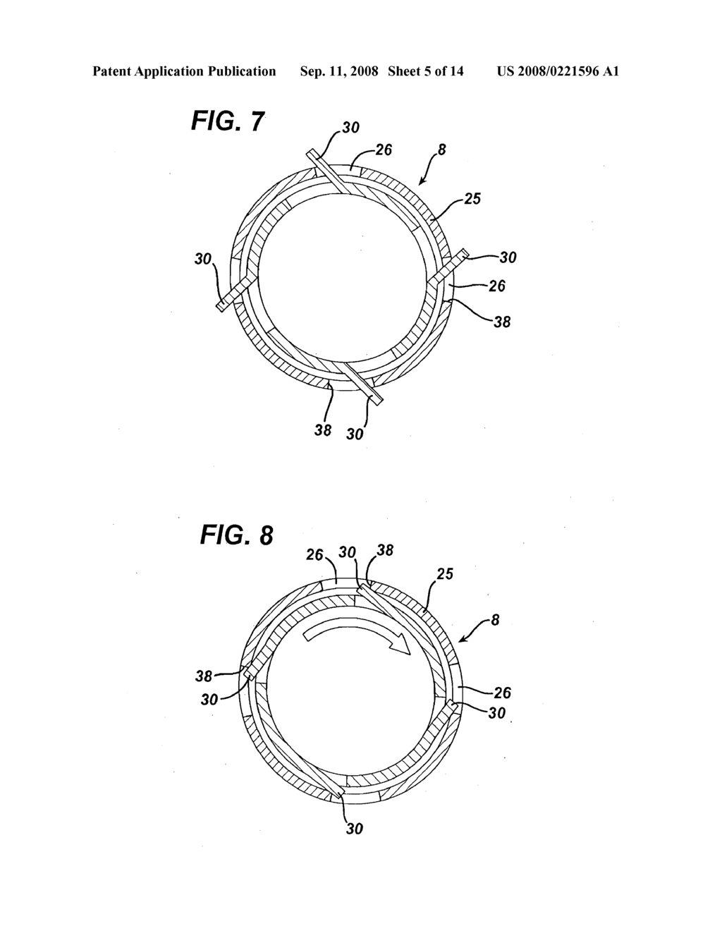 APPLIER FOR FASTENER FOR SINGLE LUMEN ACCESS ANASTOMOSIS - diagram, schematic, and image 06