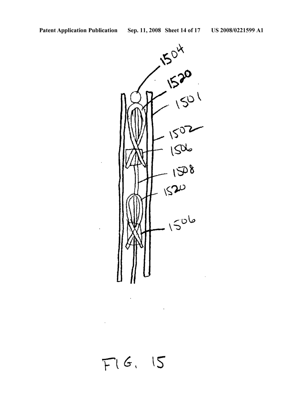 Devices, methods, and kits for gastrointestinal procedures - diagram, schematic, and image 15