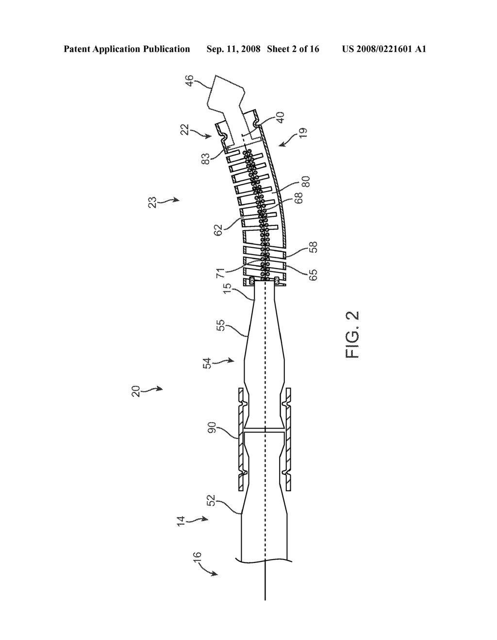 GUIDEWIRE FOR CROSSING OCCLUSIONS OR STENOSES HAVING A SHAPEABLE DISTAL END - diagram, schematic, and image 03