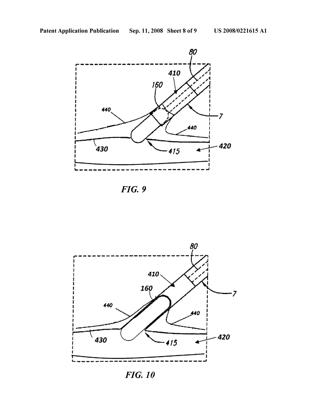 LOCATOR AND CLOSURE DEVICE AND METHOD OF USE - diagram, schematic, and image 09