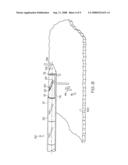 Surgical suture anchors and deployment device diagram and image