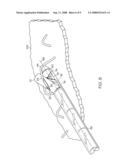 Surgical suture anchors and deployment device diagram and image