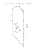 Surgical suture anchors and deployment device diagram and image