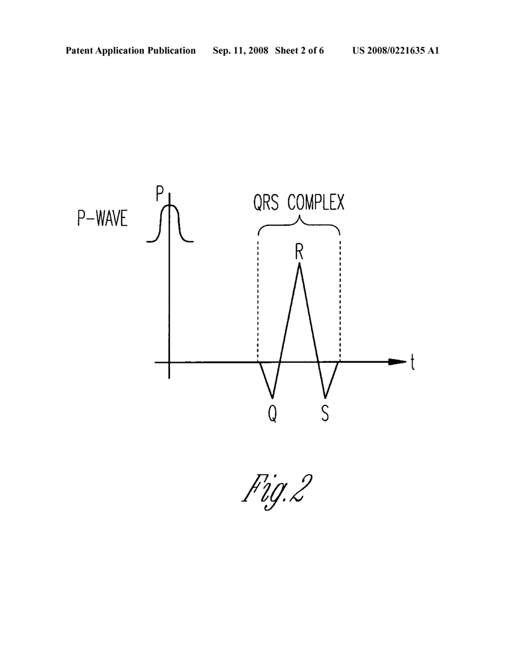 IMPLANTABLE CARDIAC RHYTHM MANAGEMENT SYSTEM HAVING MULTIPLE THERAPY MODALITIES - diagram, schematic, and image 03