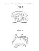 Intranasal Red Light Probe For Treating Alzheimer s Disease diagram and image