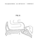 Intranasal Red Light Probe For Treating Alzheimer s Disease diagram and image