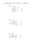 Vascular prosthesis and methods of use diagram and image