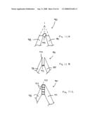 Vascular prosthesis and methods of use diagram and image