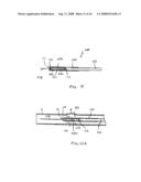 Vascular prosthesis and methods of use diagram and image