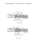 Vascular prosthesis and methods of use diagram and image