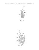 Vascular prosthesis and methods of use diagram and image