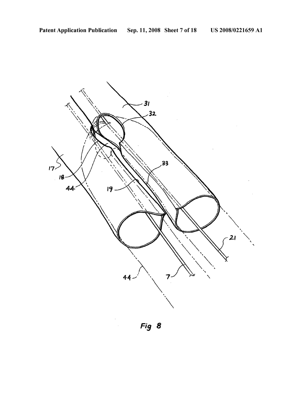 Endoscopic delivery device - diagram, schematic, and image 08