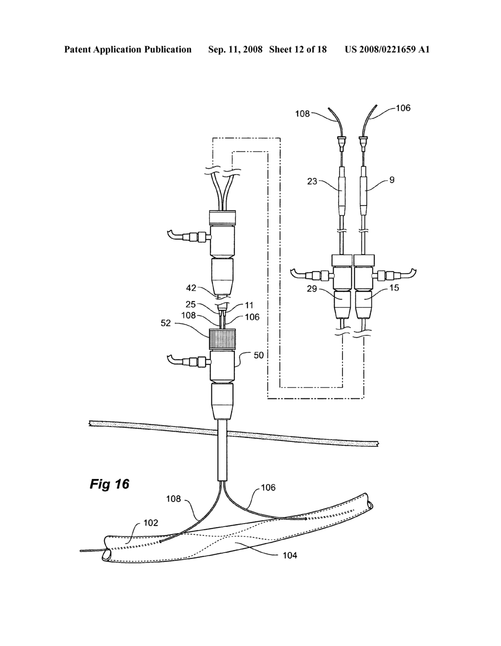 Endoscopic delivery device - diagram, schematic, and image 13