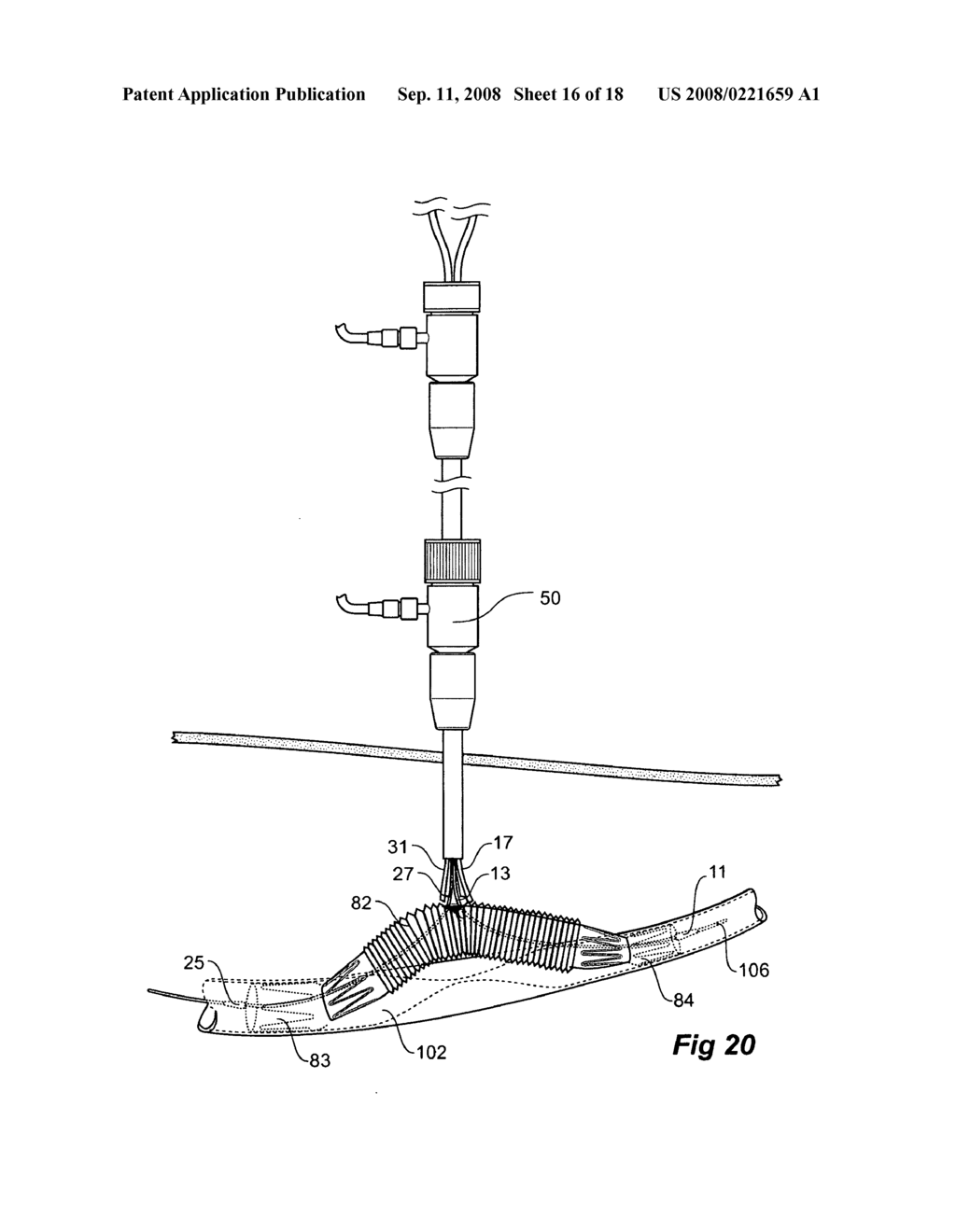 Endoscopic delivery device - diagram, schematic, and image 17
