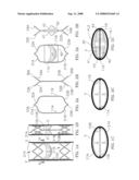 Endovenous Stent and Venous Neovalvular Endobioprosthesis diagram and image