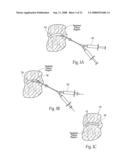 Devices, systems, and methods to fixate tissue within the regions of body, such as the pharyngeal conduit diagram and image