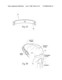 Devices, systems, and methods to fixate tissue within the regions of body, such as the pharyngeal conduit diagram and image