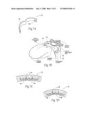 Devices, systems, and methods to fixate tissue within the regions of body, such as the pharyngeal conduit diagram and image