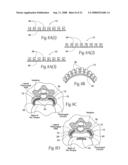 Devices, systems, and methods to fixate tissue within the regions of body, such as the pharyngeal conduit diagram and image