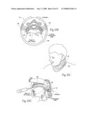 Devices, systems, and methods to fixate tissue within the regions of body, such as the pharyngeal conduit diagram and image