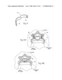 Devices, systems, and methods to fixate tissue within the regions of body, such as the pharyngeal conduit diagram and image