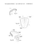 Devices, systems, and methods to fixate tissue within the regions of body, such as the pharyngeal conduit diagram and image